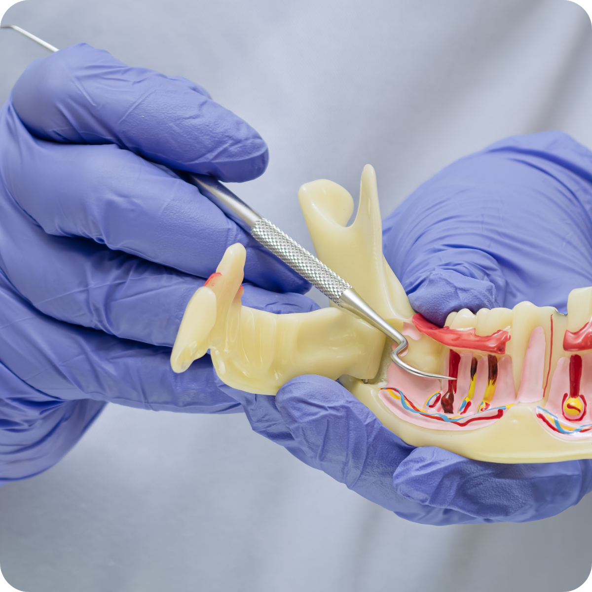 dentist holding model showing gums